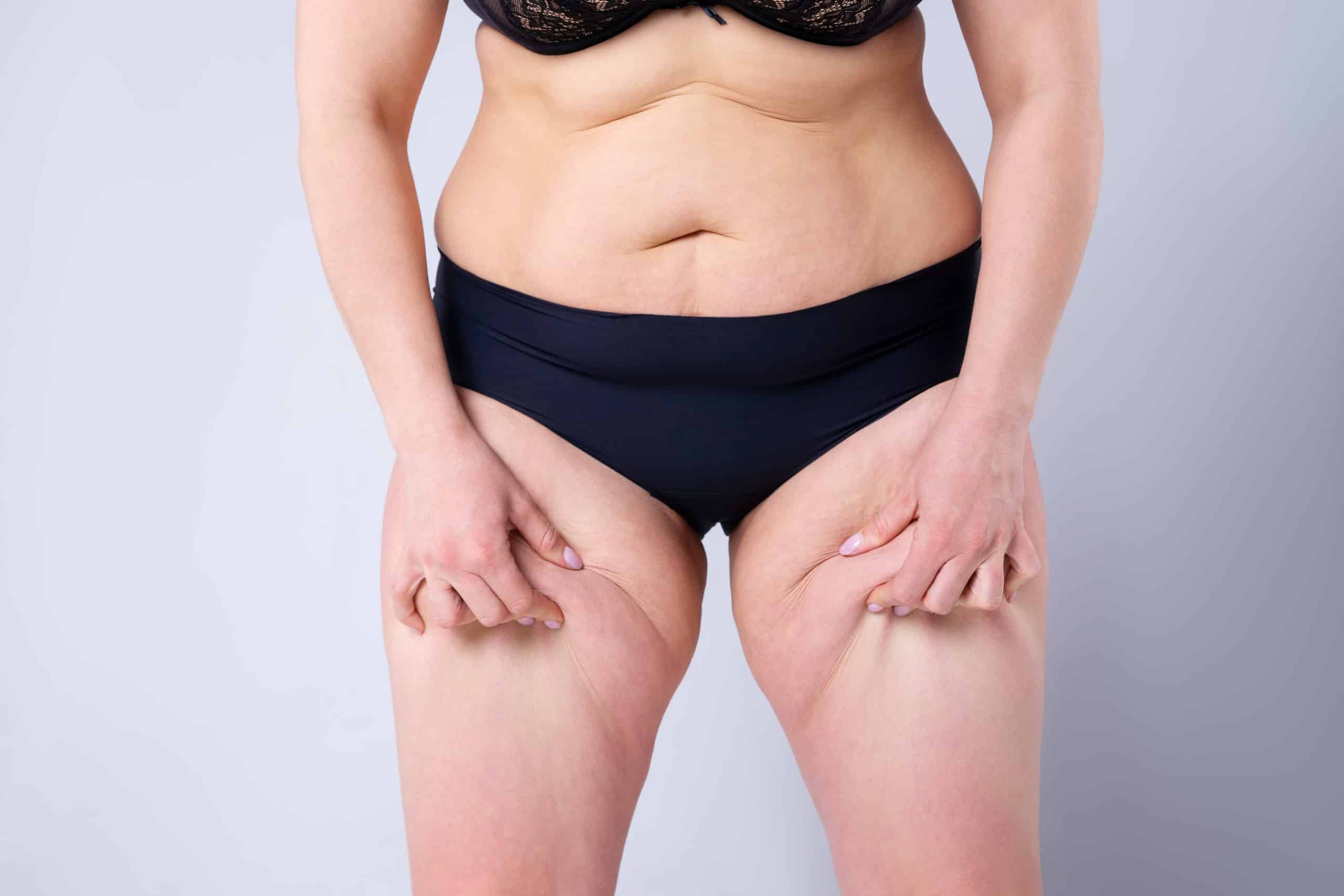 Is a Thigh Lift Right for You? — Power Plastic Surgery, Toronto